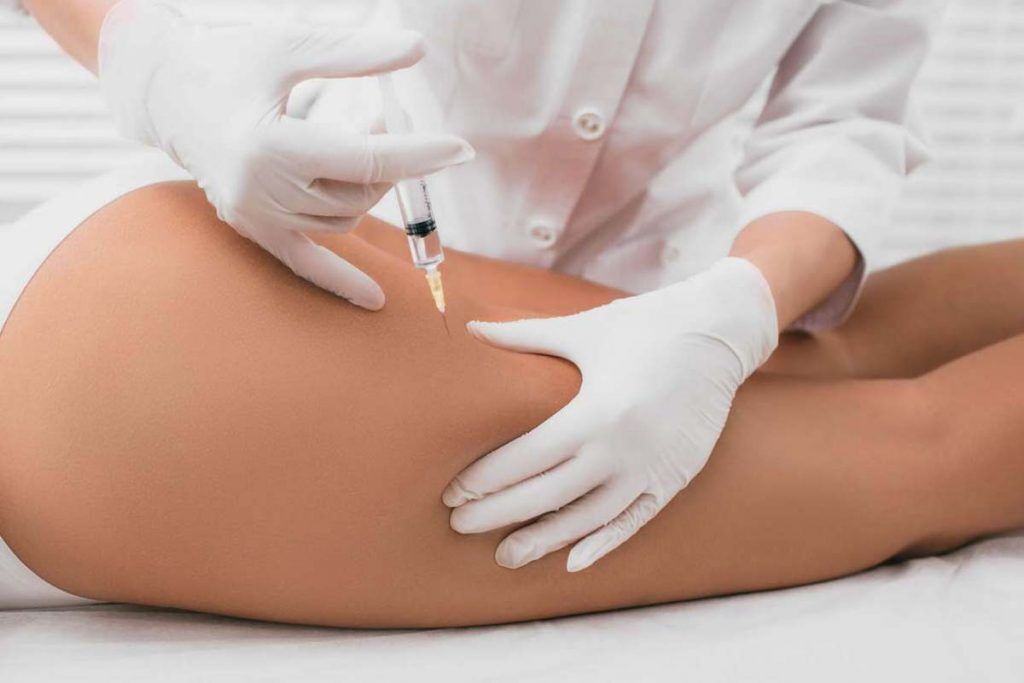 mesoterapia de l carnitina Mesoterapia Para Las Cartucheras, ¿Es efectiva?